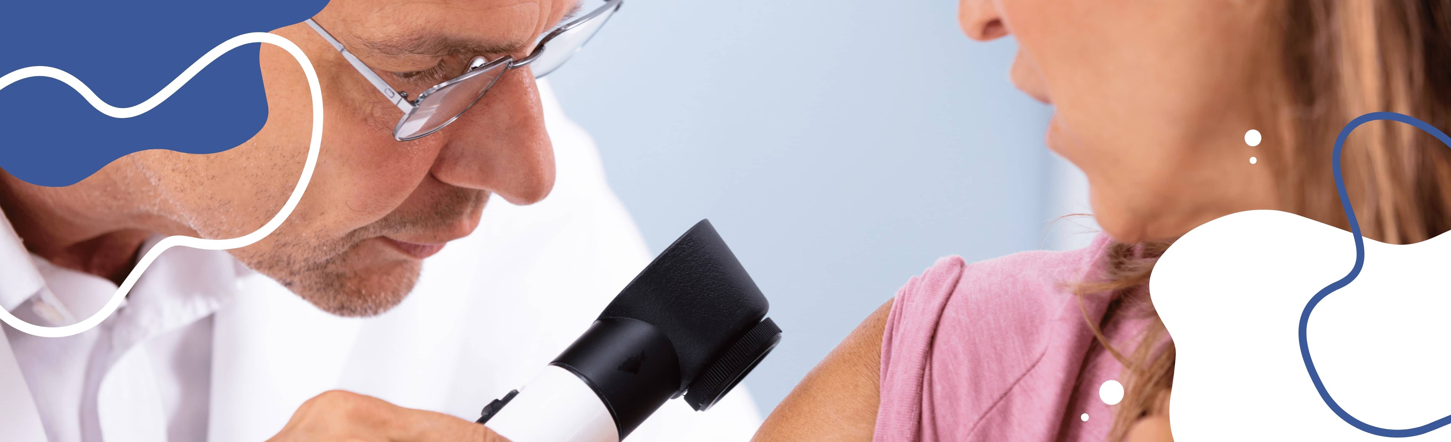 Melanoma diagnosis by a doctor